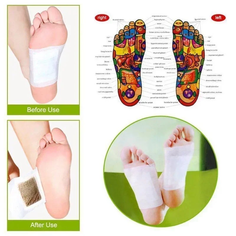 Health Wellness And Spa - Tuhopeta Korea Kinoki Parches Herbales para