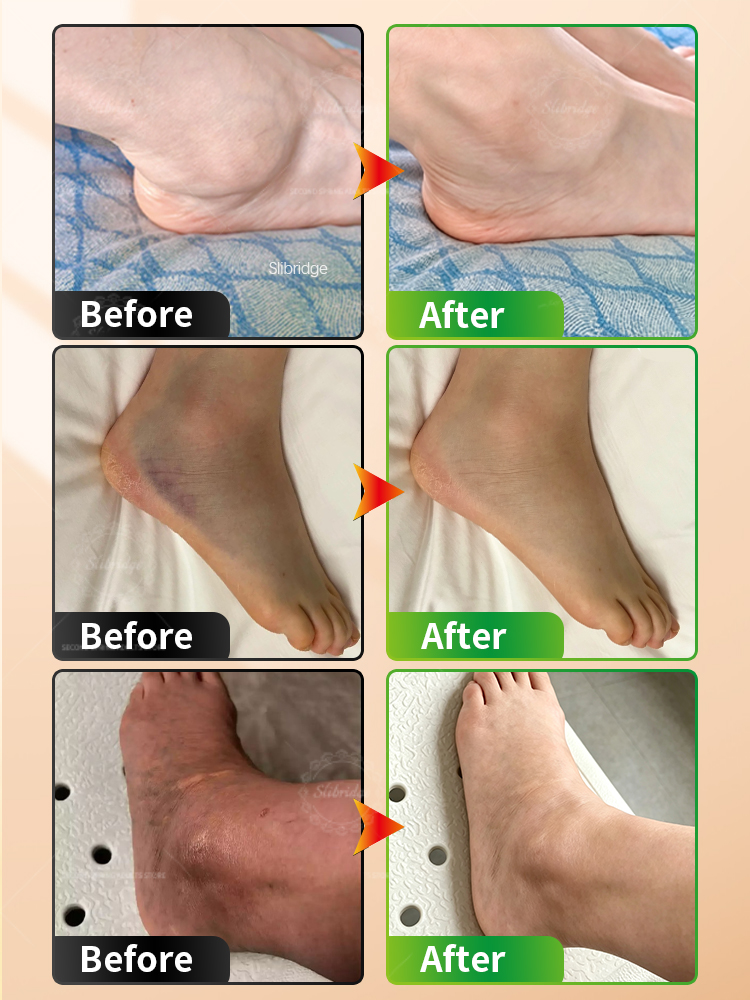 Masajeador de Tobillo Portátil - Ankle Brace Support reseña y precio